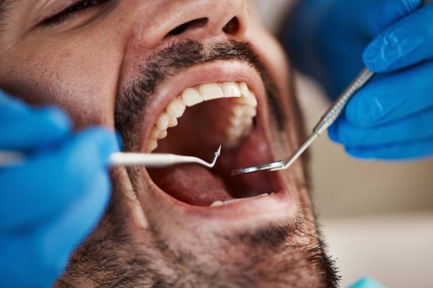 Best Periodontal (Gum) Disease Treatment  in Krugerville, TX
